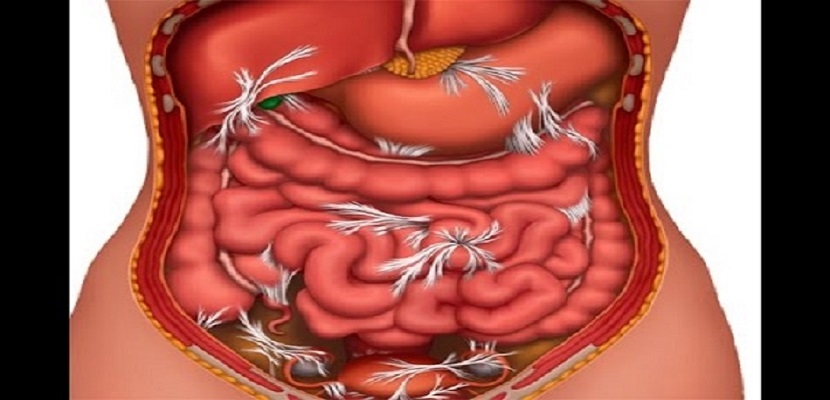 التخلص من الديدان الطفيلية الموجودة في الأمعاء