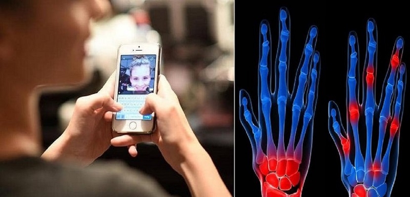 "داء الآيفون".. الهواتف الذكية تسبب ضمور مفاصل اليد وأطباء يحذرون