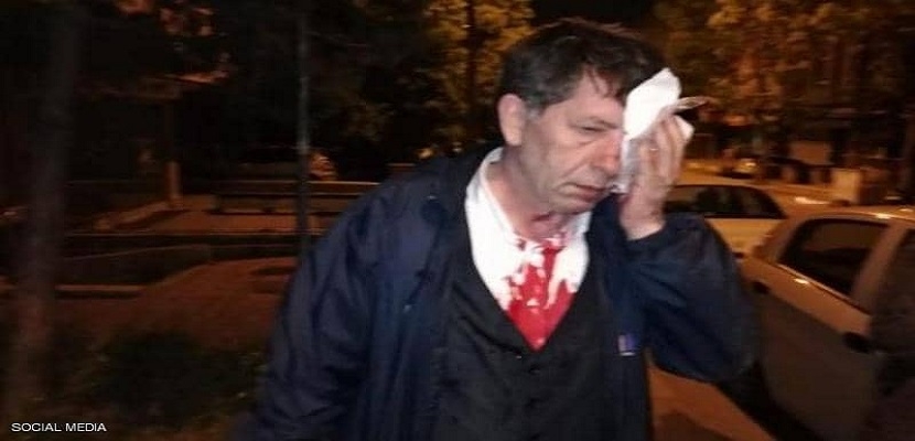 الاعتداء بالضرب على الصحفي التركي يافوز سليم ديميراغ بعد انتقاده الحكومة