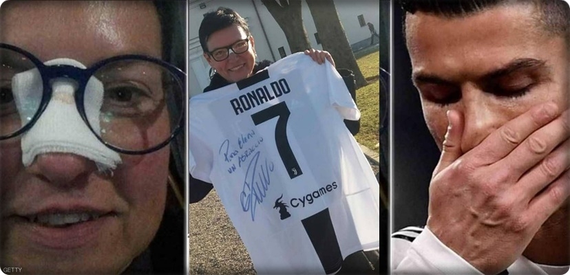 كريستيانو رونالدورونالدو كسر أنف إحدى مشجعاته